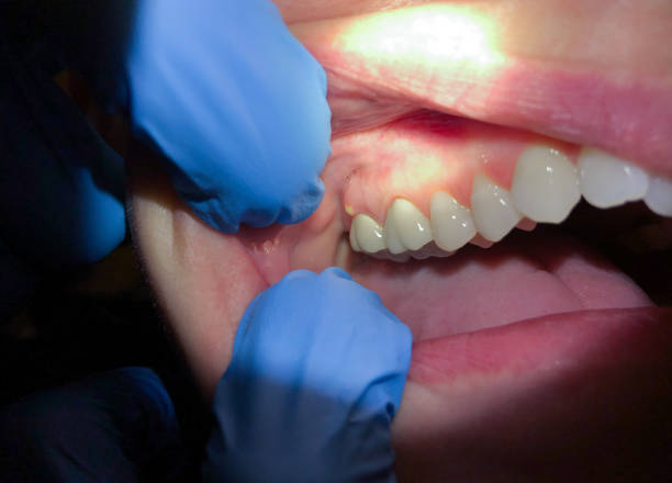 Best Cosmetic Emergency Dentistry in Dwight, IL